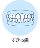 すきっ歯