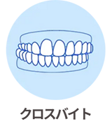 クロスバイト