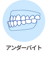 アンダーバイト